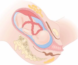 Issues with umbilical cords