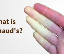 Raynaud’s Disease May Occur